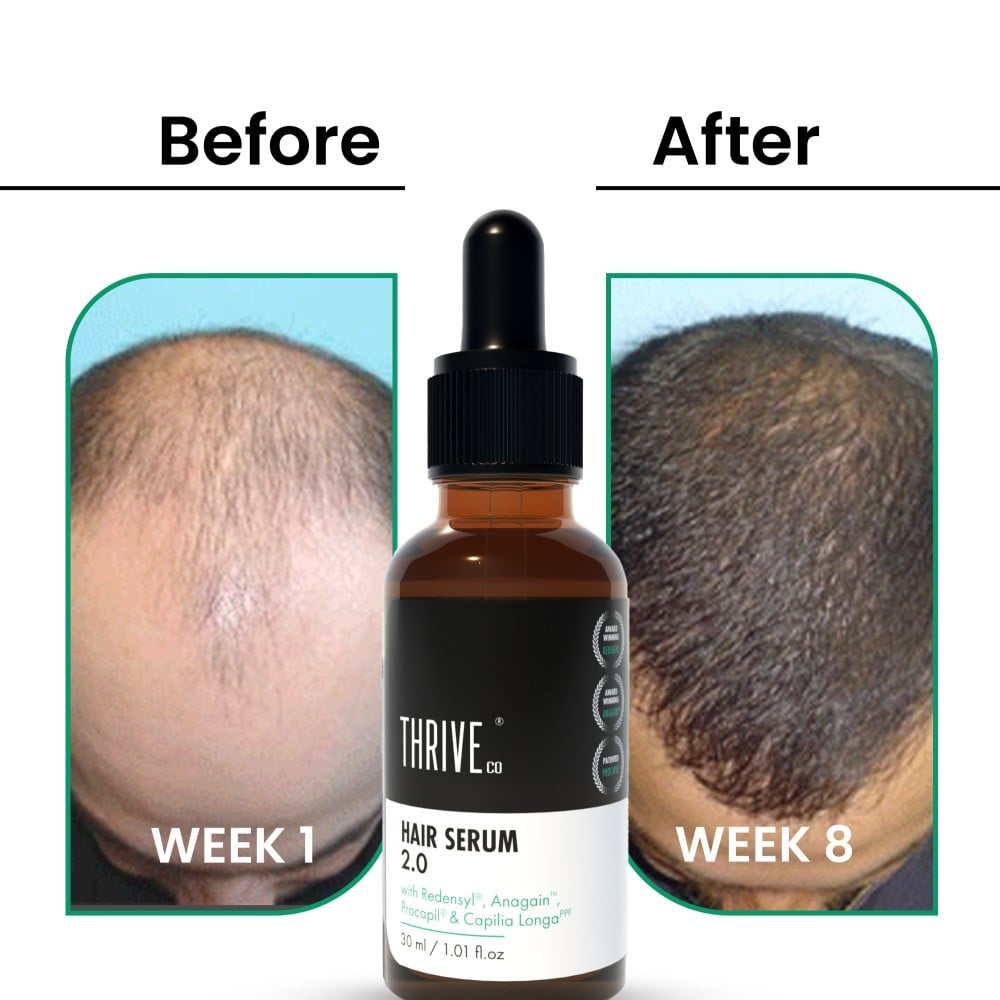 ThriveCo Hair Growth 2.0 Hair Serum : 30 ml