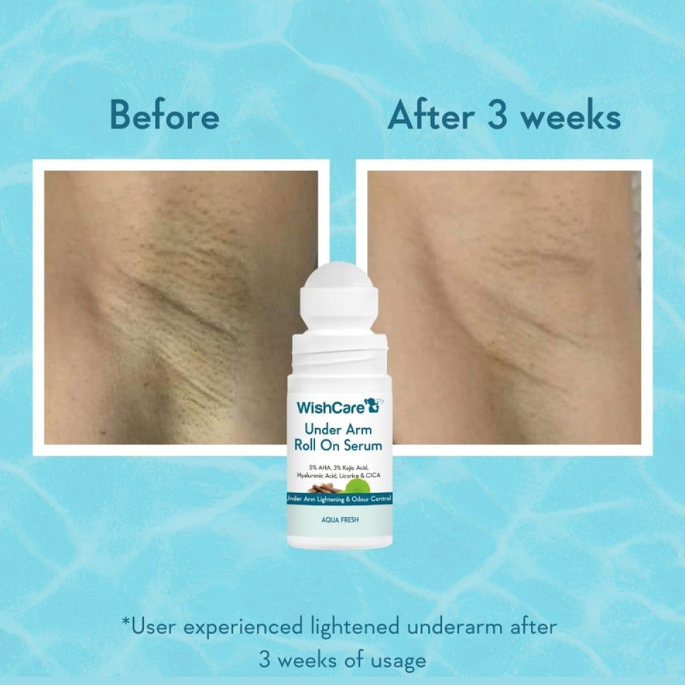 Wishcare Under Arm Roll-On Serum For Dark Under Arm (Aqua Fresh) : 50 ml