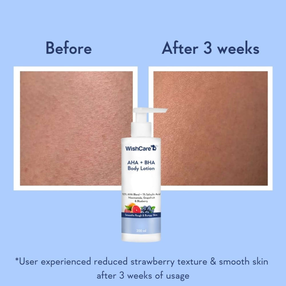 Wishcare AHA + BHA Body Lotion : 200 ml
