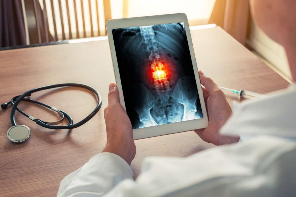 Spine Surgeons