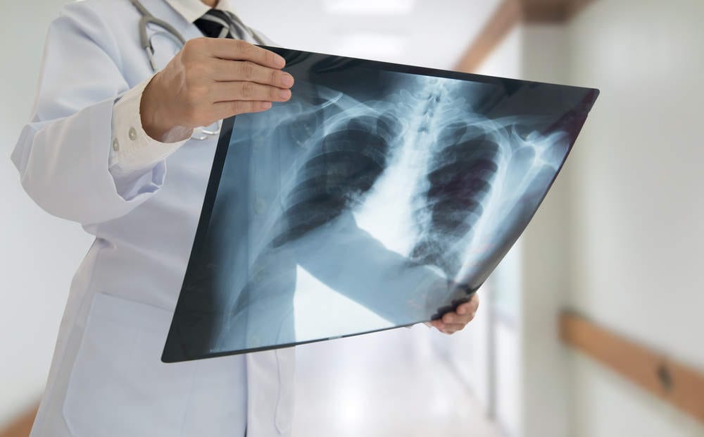 X Ray Centres