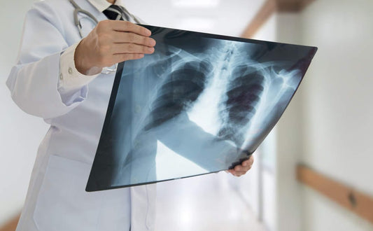 X Ray Centres