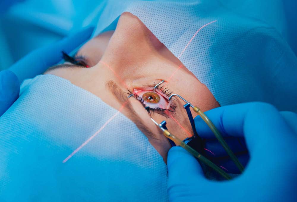 Eye Surgeon Doctors