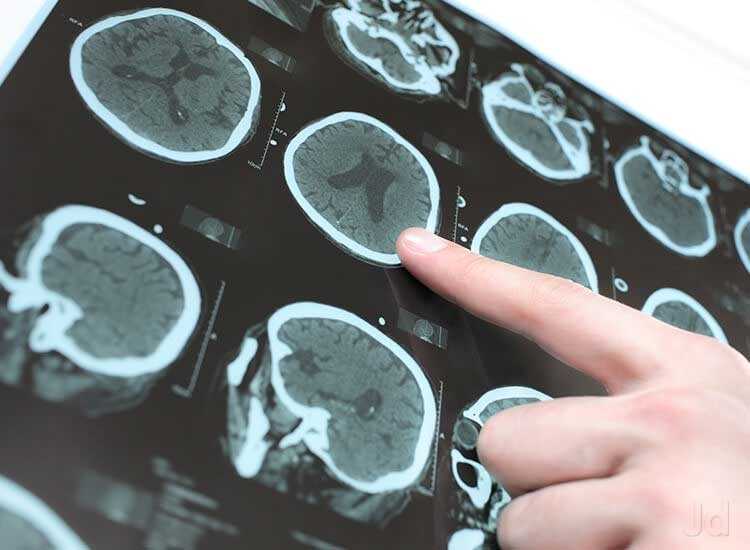 Neurologists - Prithvi Enterprises