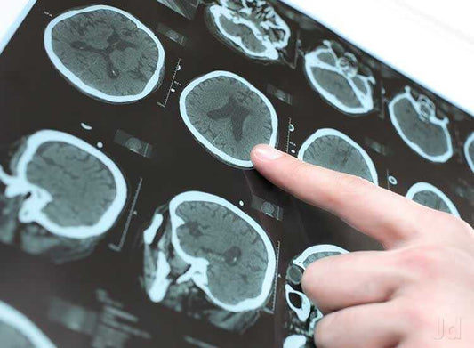 Neurologists - Prithvi Enterprises