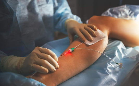 Doctors For Varicose Veins Treatment