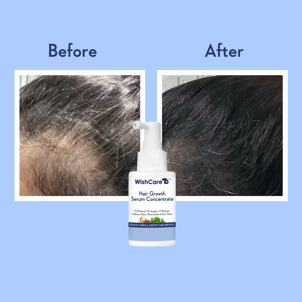 Wishcare Hair Growth Serum Concentrate with Rosemary : 30 ml