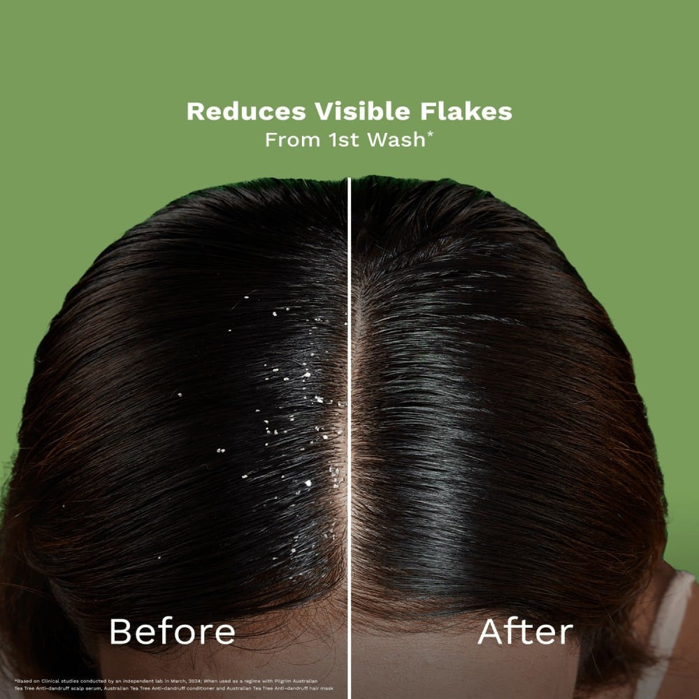 Pilgrim Australian Tea Tree Non-Drying Anti-Dandruff Shampoo - Pack of 2 : 2 x 200 ml