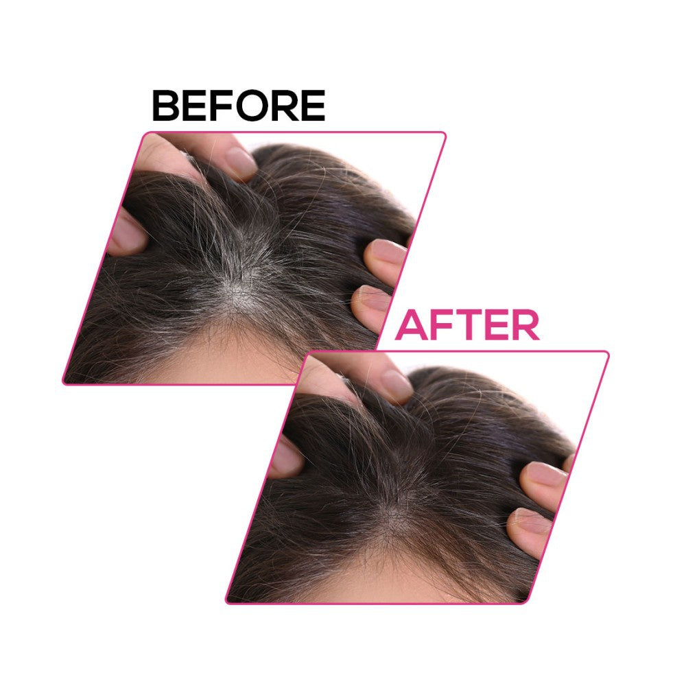 Renee Cover Up Hair Powder (Brown) - Pack of 2 : 2 x 4 g