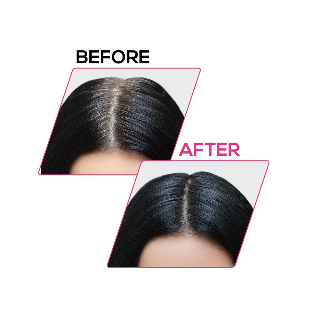 Renee Cover Up Hair Powder (Black) - Pack of 2 : 2 x 4 g