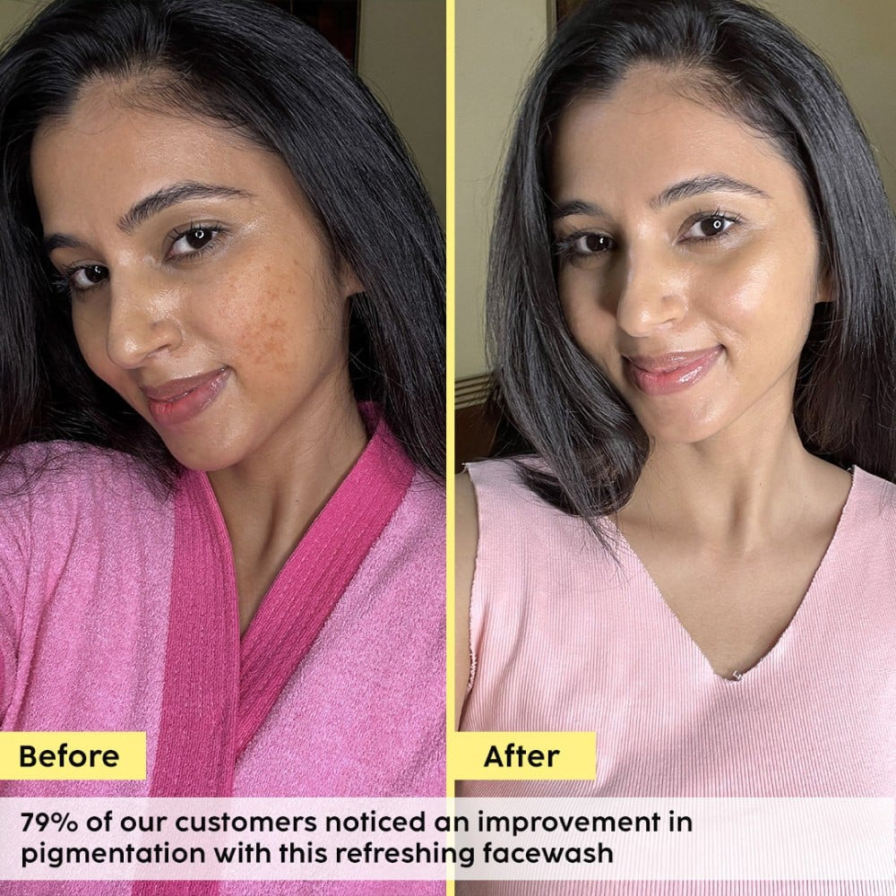 Plix Pineapple De-Pigmentation Face Cleanser : 100 ml