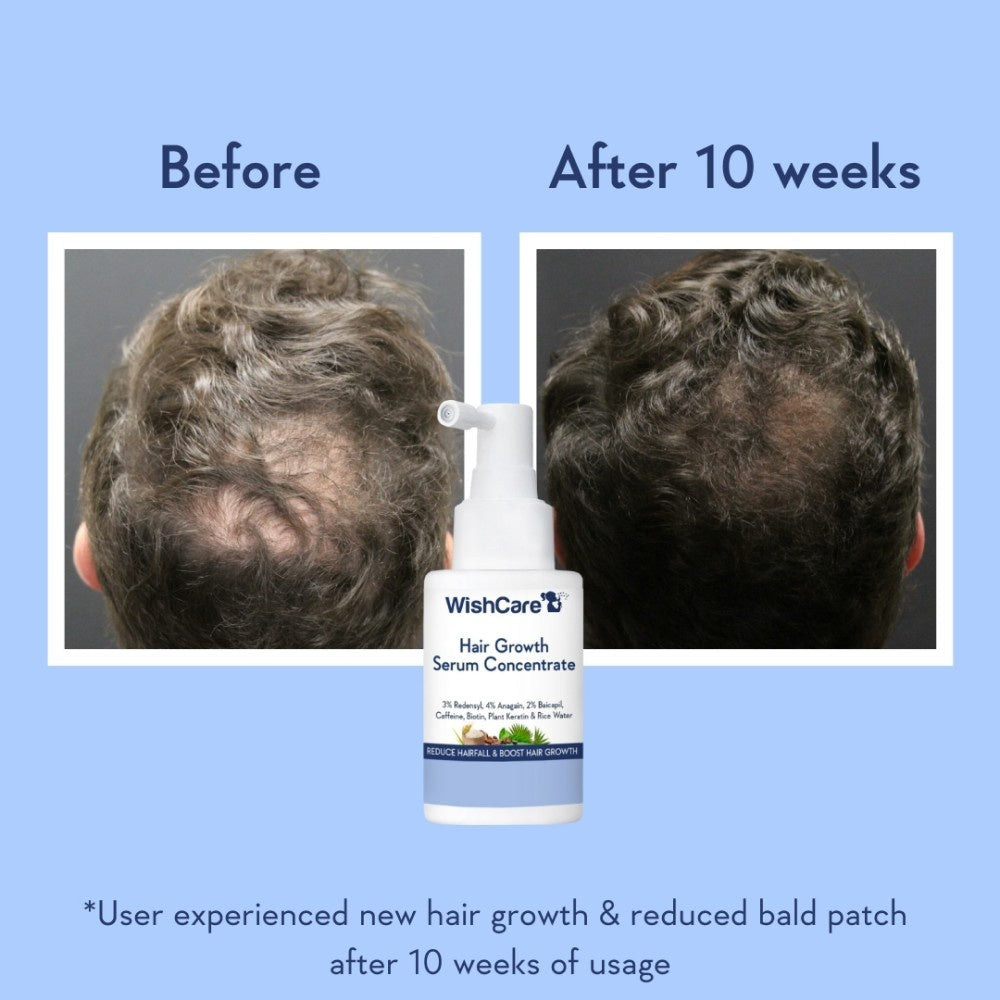 Wishcare Hair Growth Serum Concentrate with Rosemary : 30 ml