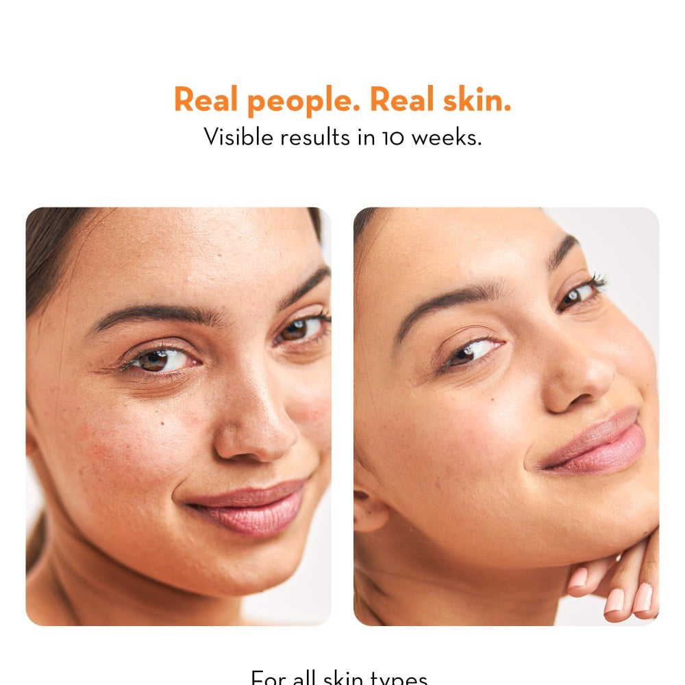 Plush High On Collagen Vitamin C Face Mist : 100 ml