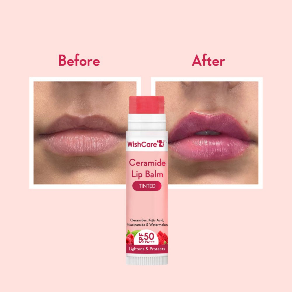 Wishcare Tinted Ceramide Lip Balm with SPF50 PA+++ (Natural Pink) : 5 g