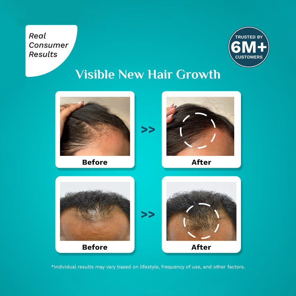 Pilgrim Redensyl & Anagain Hair Growth Serum : 50 ml